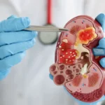 Fungsi Ginjal Organ Vital yang Menjaga Keseimbangan Tubuh