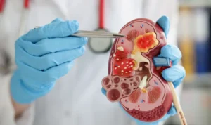 Fungsi Ginjal Organ Vital yang Menjaga Keseimbangan Tubuh