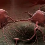 Perbedaan Tumor dan Kanker yang Harus Dipahami Masyarakat