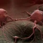 Perbedaan Tumor dan Kanker yang Harus Dipahami Masyarakat