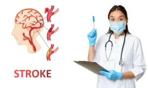 Penyebab Stroke, Dari Sumbatan Senyap sampai Pecah Pembuluh