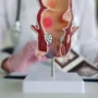 Penyebab Ambeien yang Sering Terjadi, dari Sembelit hingga Duduk Terlalu Lama